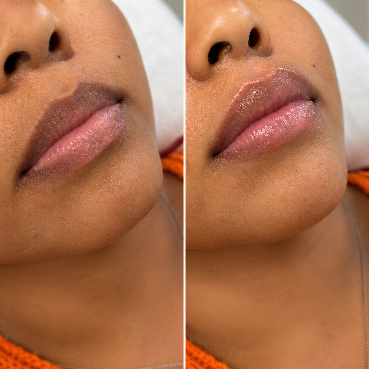 Cosmetic — additional treatment imagery
